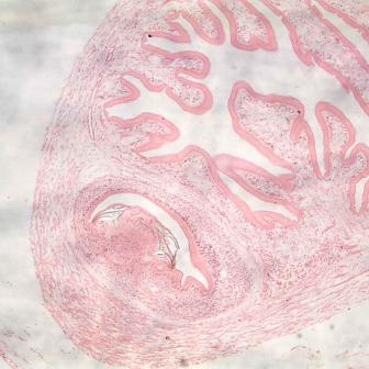 猪带绦虫头节剖面图