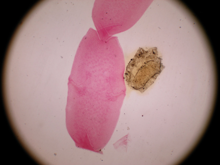 犬复孔绦虫成节