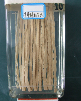牛带绦虫大体标本