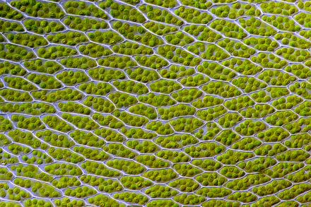 细叶真藓（Bryum capillare）细胞中可见的叶绿体