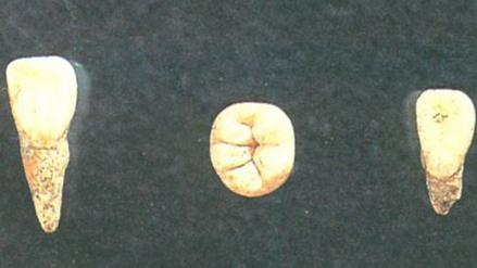 丁村人牙齿化石