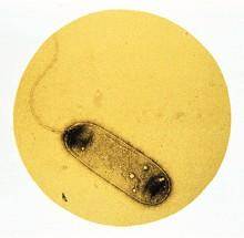 军团菌感染 军团菌感染