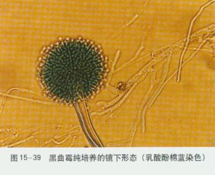 黑曲霉菌