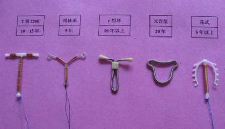 各式各样的节育环