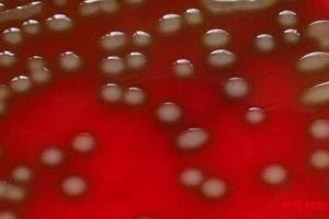 革兰阴性杆菌肺炎