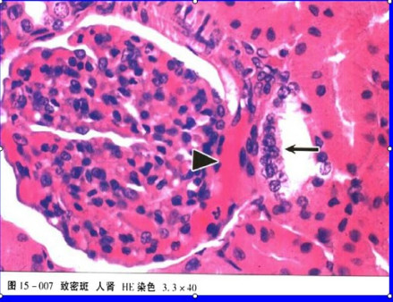 箭头所指为致密斑