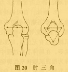 图2 肘三角