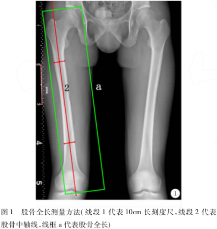 股骨头深嵌于髋臼内，其顶端不能扪及 