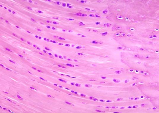 纤维软骨 纤维软骨