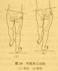 图5 单腿独立试验