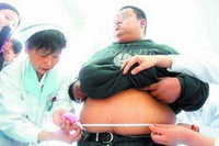 脂肪层