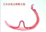 日本血吸虫雄雌合抱