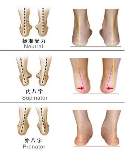 八字脚与正常脚的对比