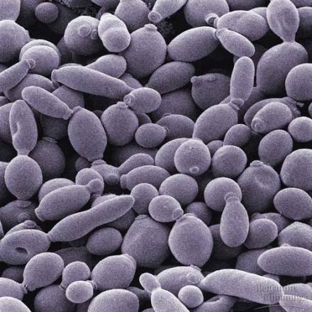 酿酒酵母的扫描电镜照片