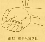 图3 握拳尺偏试验