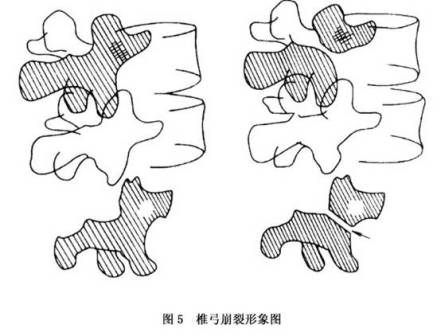 腰骶椎与脊神经