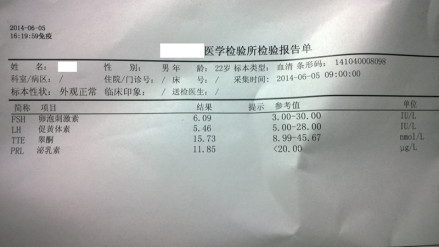 男性激素4项