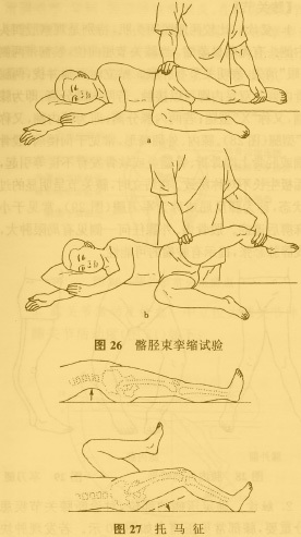 图7 髂胫束挛缩试验和托马征