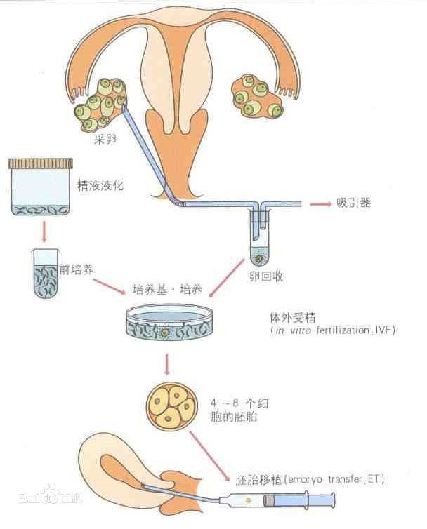 体外受精示意图 来源于百度百科