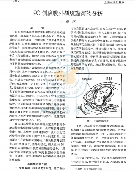 王淑贞在1956年发表的论文《90例腹膜外剖腹产术的分析》