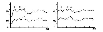 视神经损害颅脑损伤