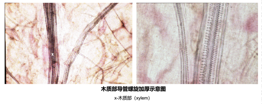 木质部导管螺旋加厚示意图
