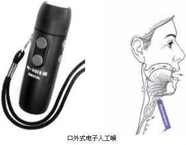 口外式电子人工喉