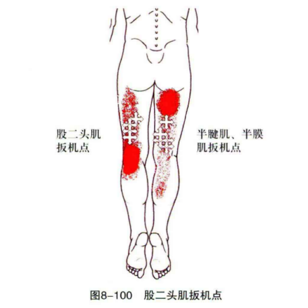 股二头肌扳机点 
