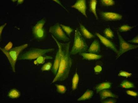 肿瘤细胞培养图片