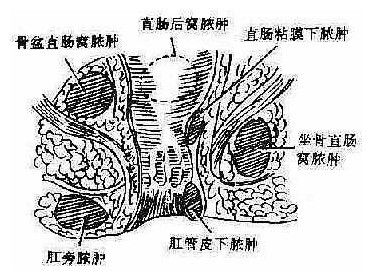 肛门直肠疾病