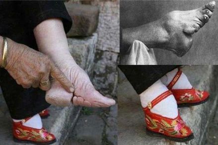 缠足图片