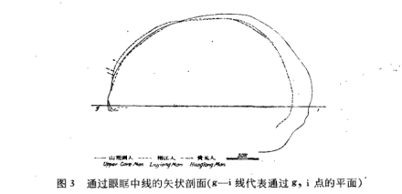 通过眼眶中线的矢状剖面
