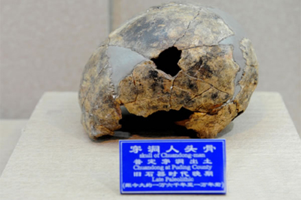 穿洞人头骨