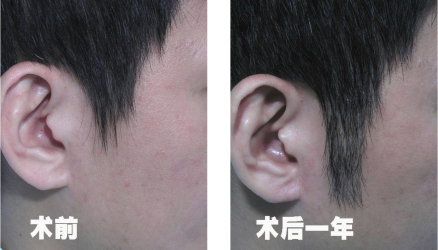 鬓角