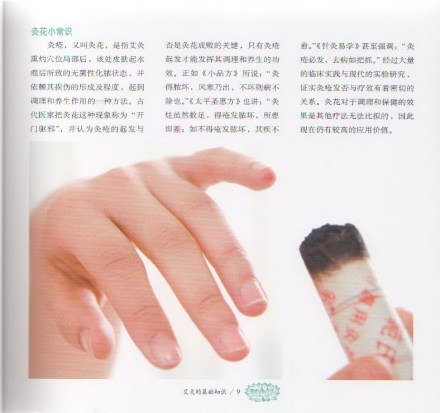 艾灸示意图