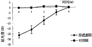 屈光度