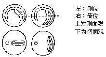 侧位