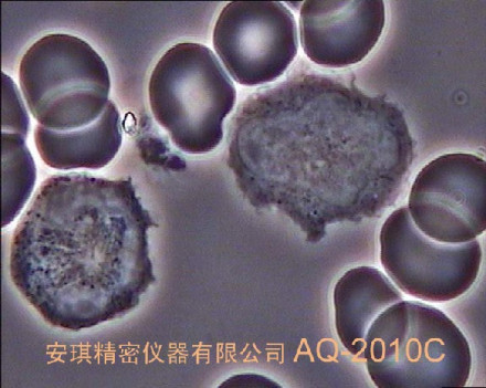 B淋巴细胞