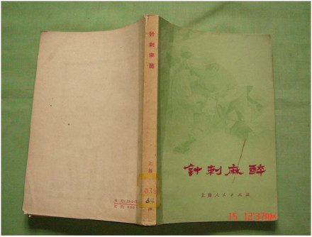 针刺麻醉