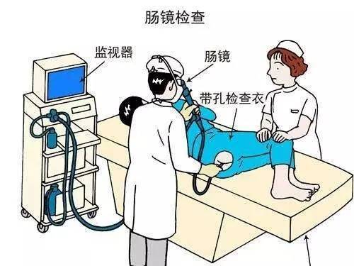 检查过程示意图