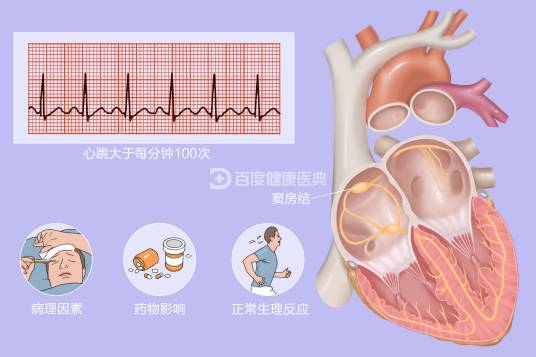 窦性心动过速 窦性心动过速
