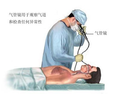 镜检