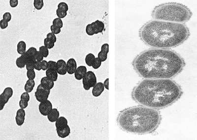 溶血性链球菌 溶血性链球菌