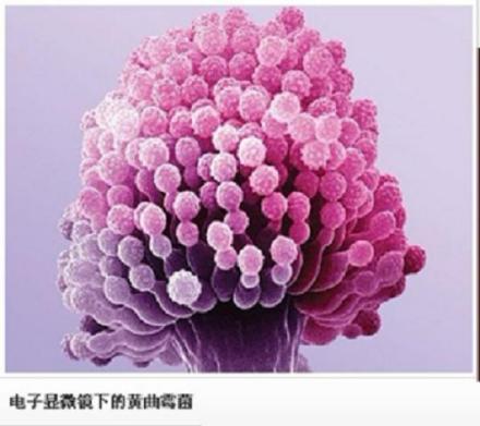 电镜下的黄曲霉菌