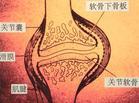 关节图