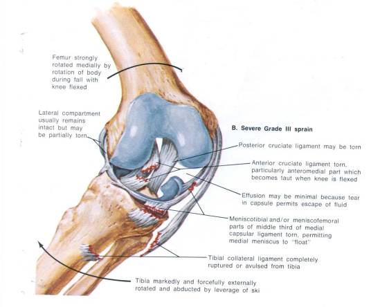关节软骨 关节软骨