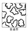 普通型