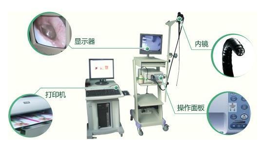 电子结肠镜构成