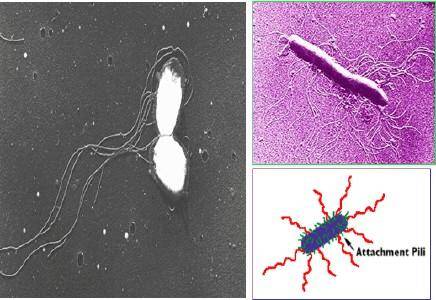 鞭毛运动 鞭毛运动