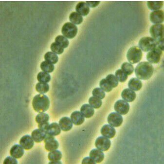 厌氧氨氧化反应